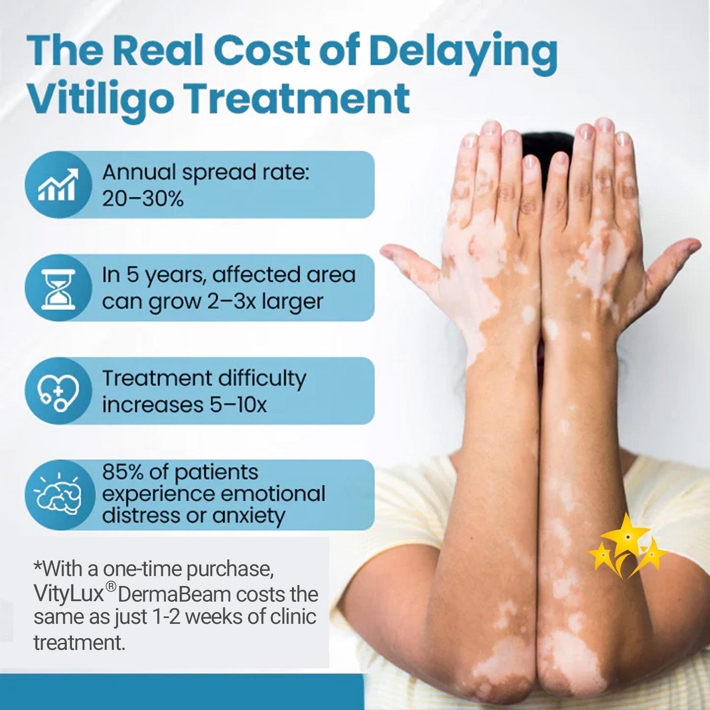 💥 2025 Hot Sale 70% OFF 🔥 VityLux® DermaBeam Vitiligo Laser Therapy System