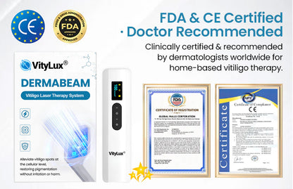 💥 2025 Hot Sale 70% OFF 🔥 VityLux® DermaBeam Vitiligo Laser Therapy System
