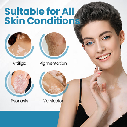 💥 2025 Hot Sale 70% OFF 🔥 VityLux® DermaBeam Vitiligo Laser Therapy System